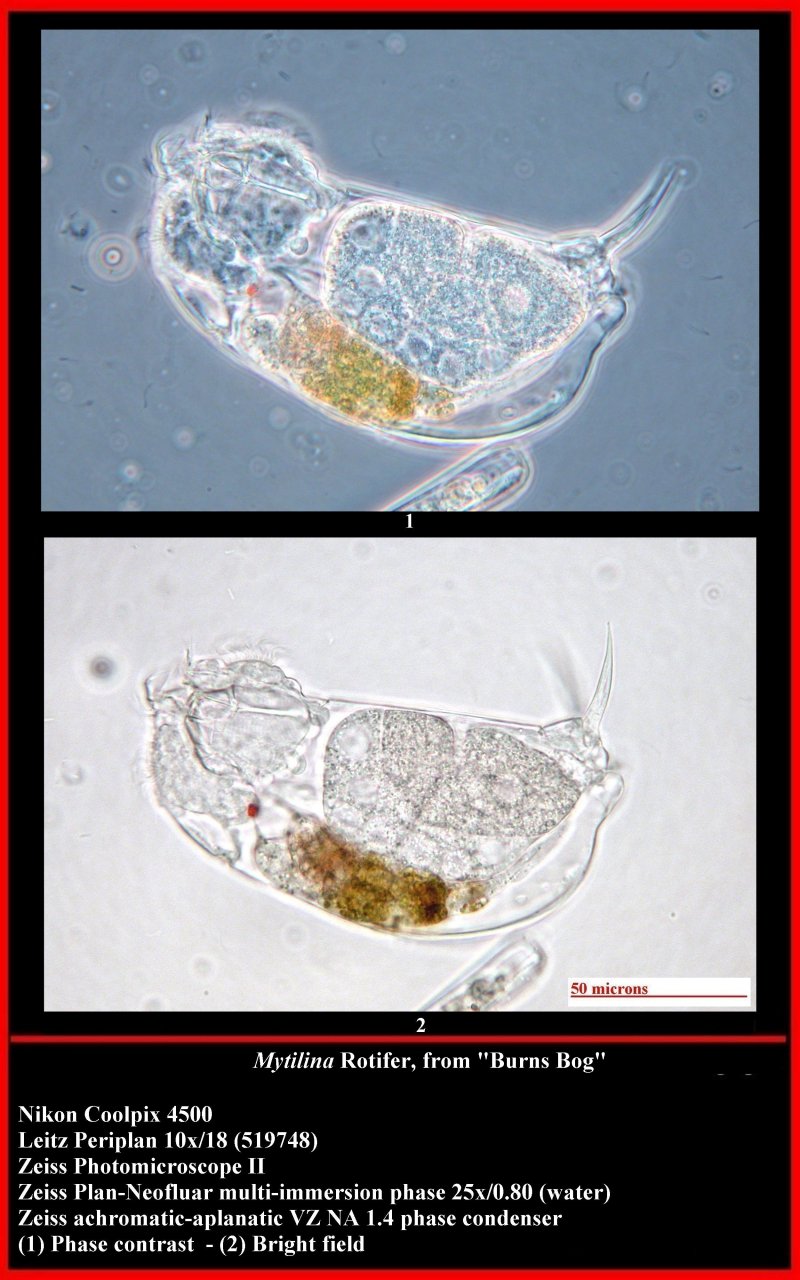phase contrast - brightfield