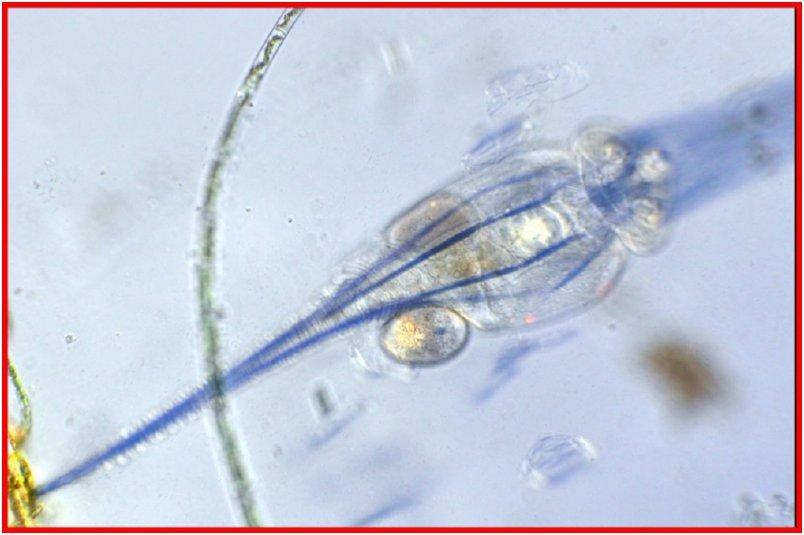 Rotifer (Collotheca sp) muscle tissue
