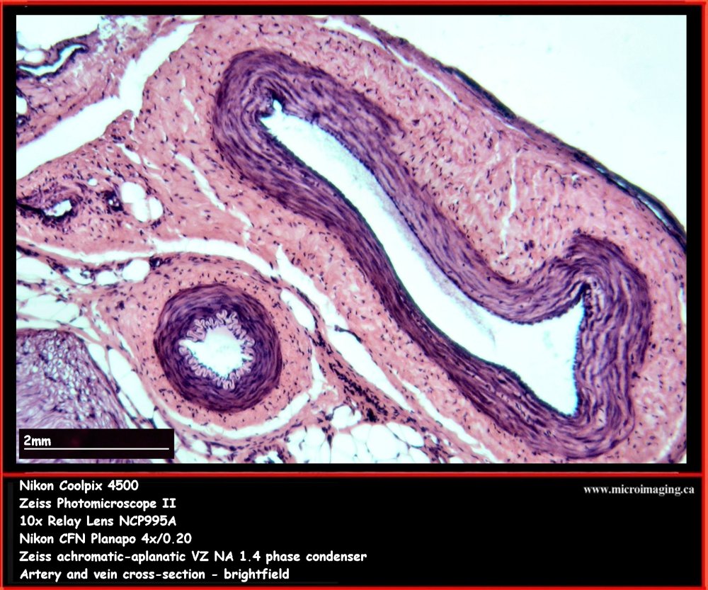 Artery & Vein, cross section
