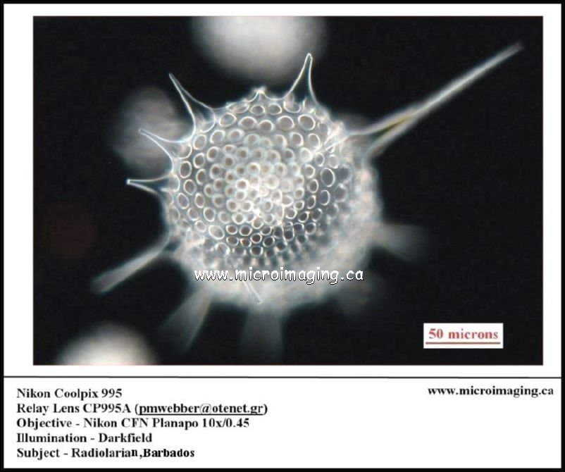 Radiolarian