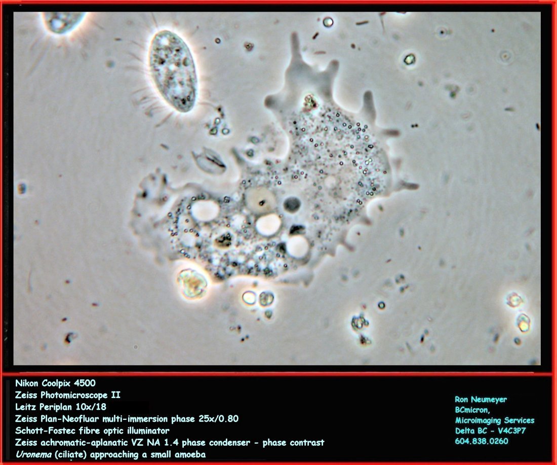Amoeba