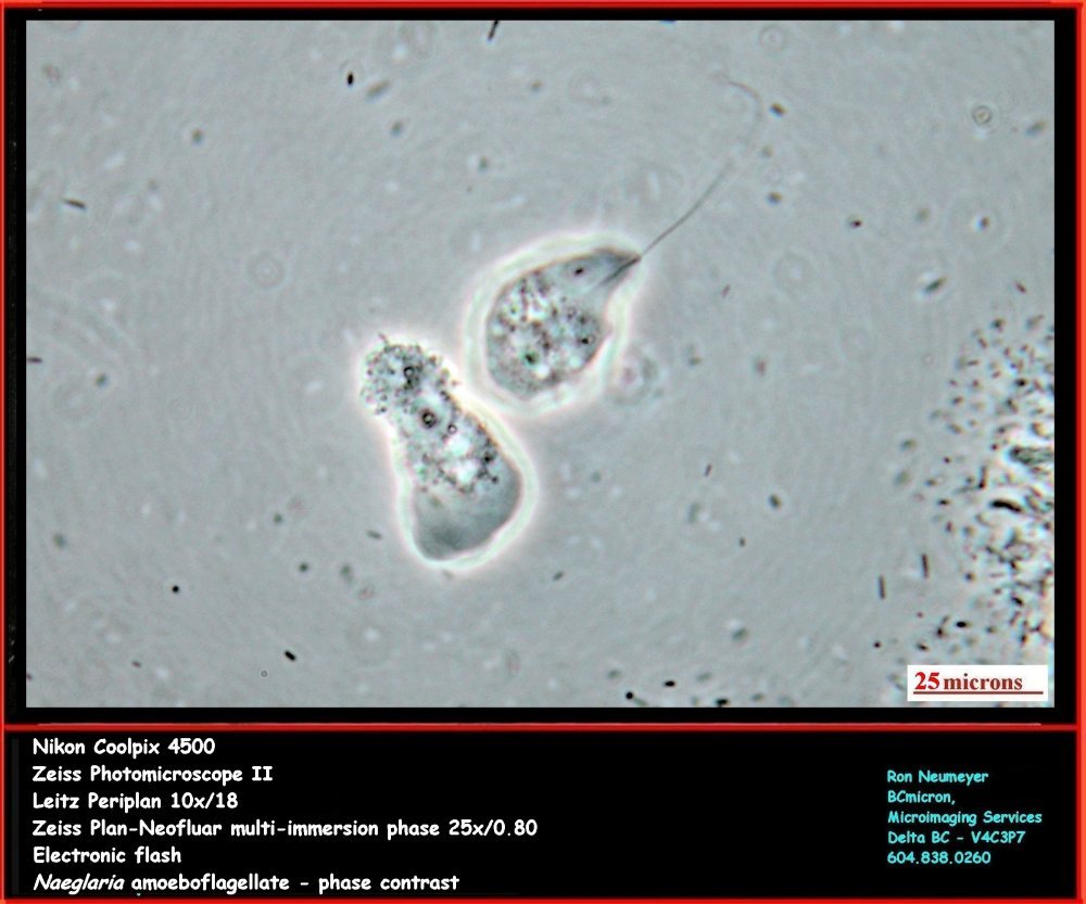 Amoeba