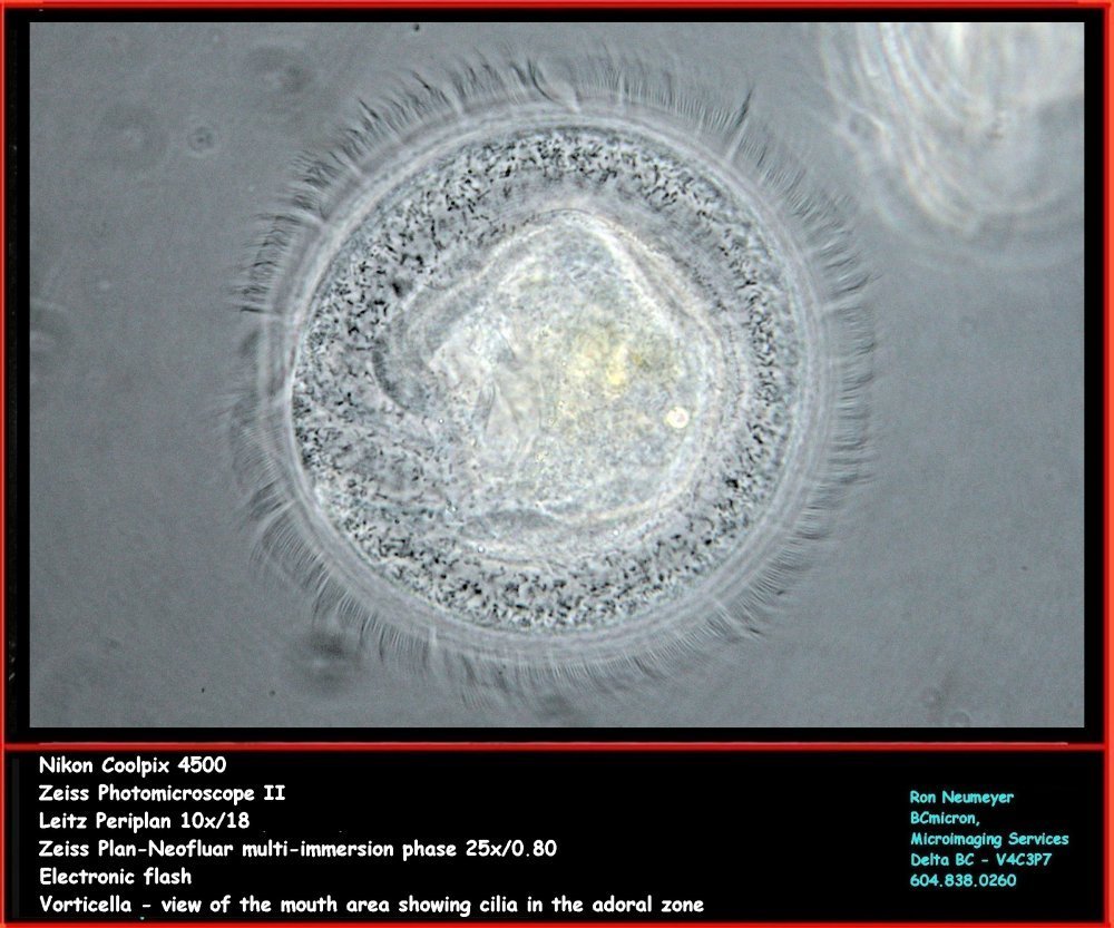 Vorticella